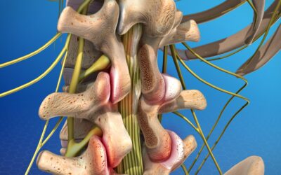 Failed Back Syndrome: Travel to India and get New Hope